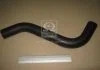 Патрубок радиатора верхний HYUNDAI ACCENT (пр-во) PARTS-MALL PXNLA001 (фото 2)