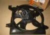 Вентилятор охолодження HYUNDAI Accent II (MC) (вир-во) PARTS-MALL PXNAA034 (фото 2)