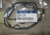 Прокладка клапанної кришки Hyundai/Kia/Mobis 224412A102 (фото 2)