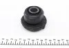 Комплект монтажный рычага MERCEDES 76-85 перед. мост низ (Пр-во FEBI) FEBI BILSTEIN 04103 (фото 4)