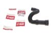 Coolant hose VIKA 11211475401 (фото 2)