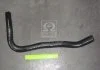 Патрубок радіатора верхній Hyundai Tucson (вир-во) PARTS-MALL PXNLA238 (фото 2)